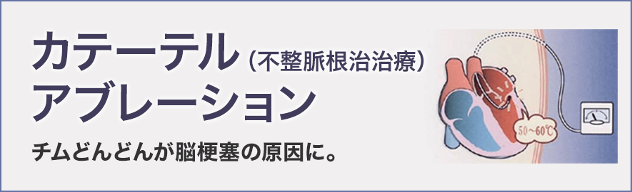 カテーテル アブレーション（不整脈根治治療）